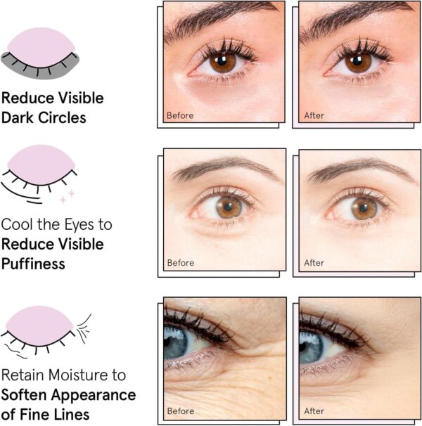 Grace & Stella Award-Winning Under Eye Mask (48 Pairs, Gold) – Puffy Eyes, Dark Circles & Wrinkle Repair | Vegan Gel Eye Patches for Radiant Skin | Self Care Gift for Women & Travel Essential - Image 4