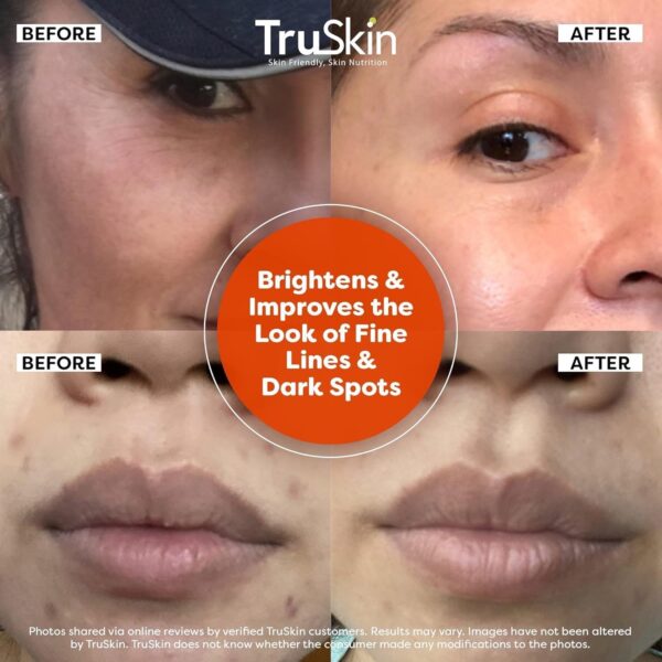 TruSkin Vitamin C Serum for Face – Anti-Aging & Brightening Serum with Vitamin C, Hyaluronic Acid & Vitamin E – Fades Dark Spots, Improves Skin Tone & Reduces Wrinkles – 1 Fl Oz - Image 5